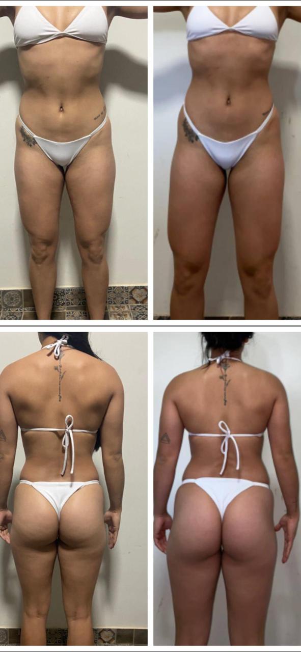 Transformação completa - Ganho de massa muscular